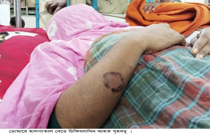ডোমারে মামা শ্বশুরের কামড়ে ভাগনে বউ হাসপাতালে ভর্তি